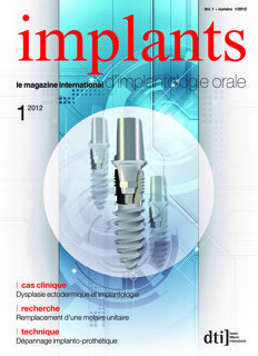 implants France No. 1, 2012