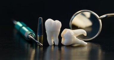 VGZ contracteert te weinig tandartsen-implantologen, vindt ANT