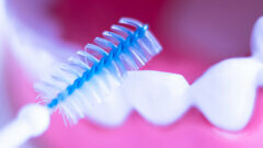 对付牙周病更有效：齿间刷和橡胶齿间刷！