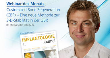 Live-Webinar zu Customized Bone Regeneration (CBR)