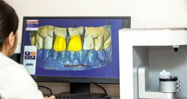 Интервю за оценка на разходите при въвеждане на 3D принтер в денталната практика