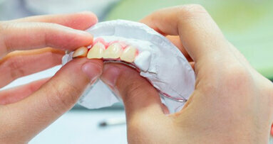 Molti pazienti con perdita dei denti non avrebbero bisogno di protesi