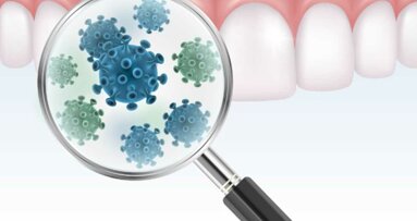 新型コロナウイルスは、歯肉から肺に入る可能性があると専門家が発表