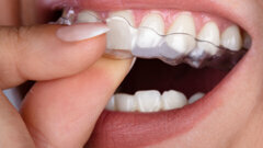 Launch of Aligner Dental Academy announced
