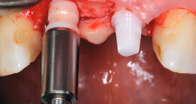 Bredent implant awarded quality mark at EAO congress