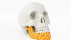 Nova revisão abrangente da impressão 3D em cirurgia oral e maxilofacial