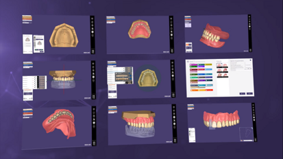 NOW AVAILABLE: DentalCAD 2.4 Plovdiv!