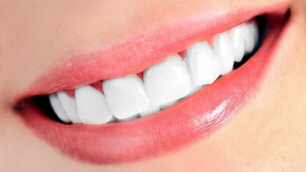 “EU-regels voor tandenbleken werken averechts”