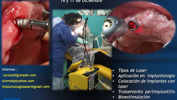 Curso de Láser en Implantología