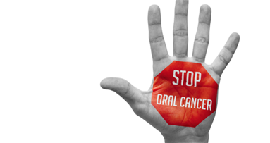 Statt Chemotherapie: Medikament zur Therapie von Mundkrebs