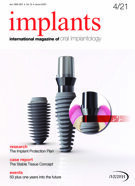 implants international No. 4, 2021
