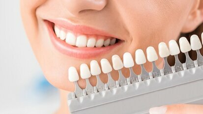 南昌大学研究人员开发出全新低创牙齿美白技术
