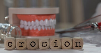 Une étude examine la manière dont les dentistes danois traitent l'érosion dentaire