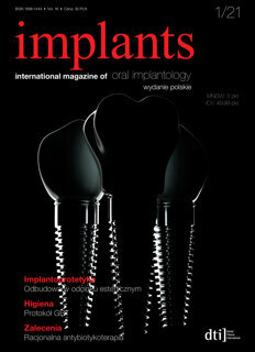 implants-poland-no-1-2021