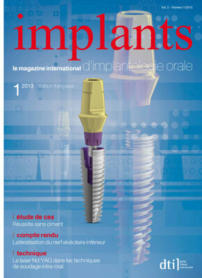 implants France No. 1, 2013