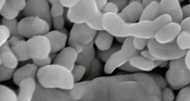 Silver nanoparticles in dentistry