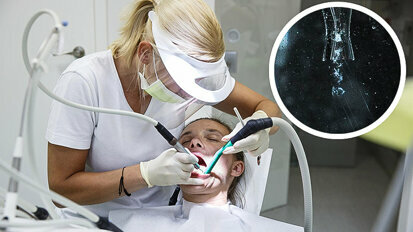 空化射流能够更轻易地移除牙菌斑
