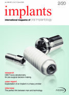 implants international No. 2, 2020