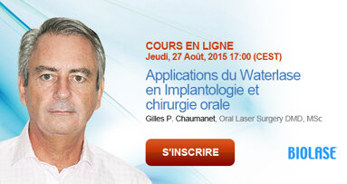 Webinaire « Applications du Waterlase en Implantologie et chirurgie orale »