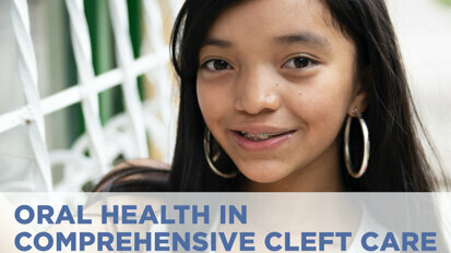 FDI webinar to discuss oral health in comprehensive cleft care