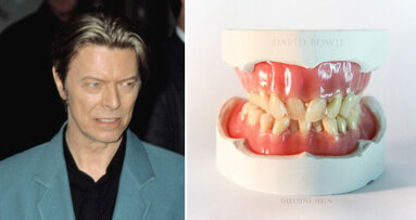 Interview: “Bowie’s teeth were like everything else about him: different”
