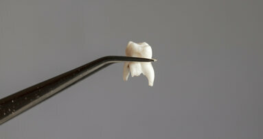 机器学习算法可能有助于预测牙齿缺失
