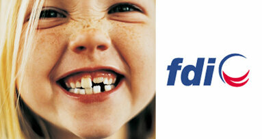 FDI представи нов подход за справяне със зъбния кариес