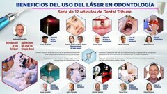 Edición Especial sobre Láser en Odontología