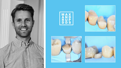 Interview: “It all starts with the right dentine bonding agent”