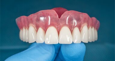 O futuro é agora: revolucionando a Odontologia com próteses digitais