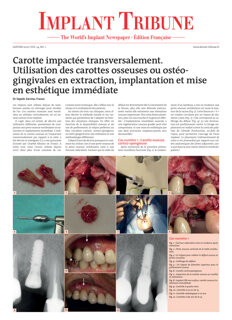 implant-tribune-france-no-1-2022