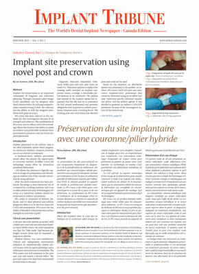 Implant Tribune Canada No. 3, 2014