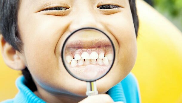 近六分之一的上海儿童患有牙齿侵蚀症