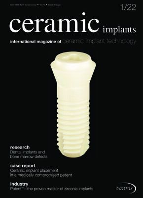ceramic implants international No. 1, 2022