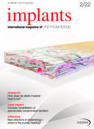 implants international No. 2, 2022