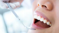 New study looks at factors that influence willingness to attend dental check-ups