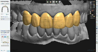 Smile analysis—Converting digital designs into the final smile Part II