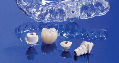 Clinical benefits of the Inclusive Tooth Replacement Solution