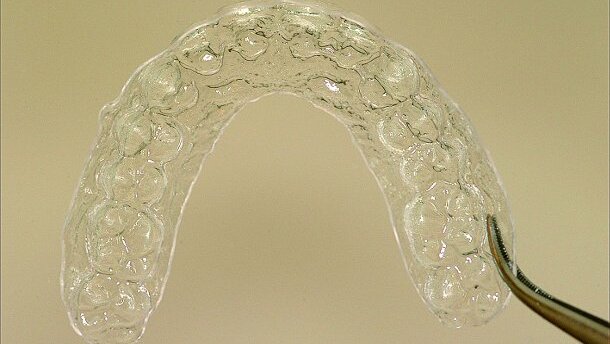イークライナー（eCligner）－審美的歯列矯正装置