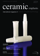 ceramic implants international No. 2, 2021