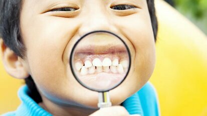 近六分之一的上海儿童患有牙齿侵蚀症