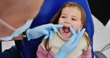 Estudo mostra que obturações podem não ser o melhor tratamento para cárie dentária na infância