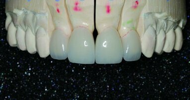Photographie numérique dentaire – Partie II - Proposition de protocole de prises de vues pour des bilans plus pratiques, plus rapides et plus efficaces en dentisterie cosmétique