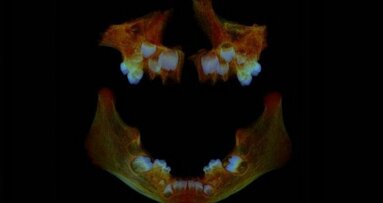 Dentes podem ajudar a identificar problemas de saúde modernos